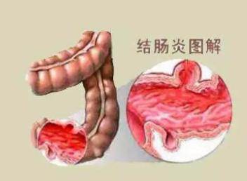 滑肠